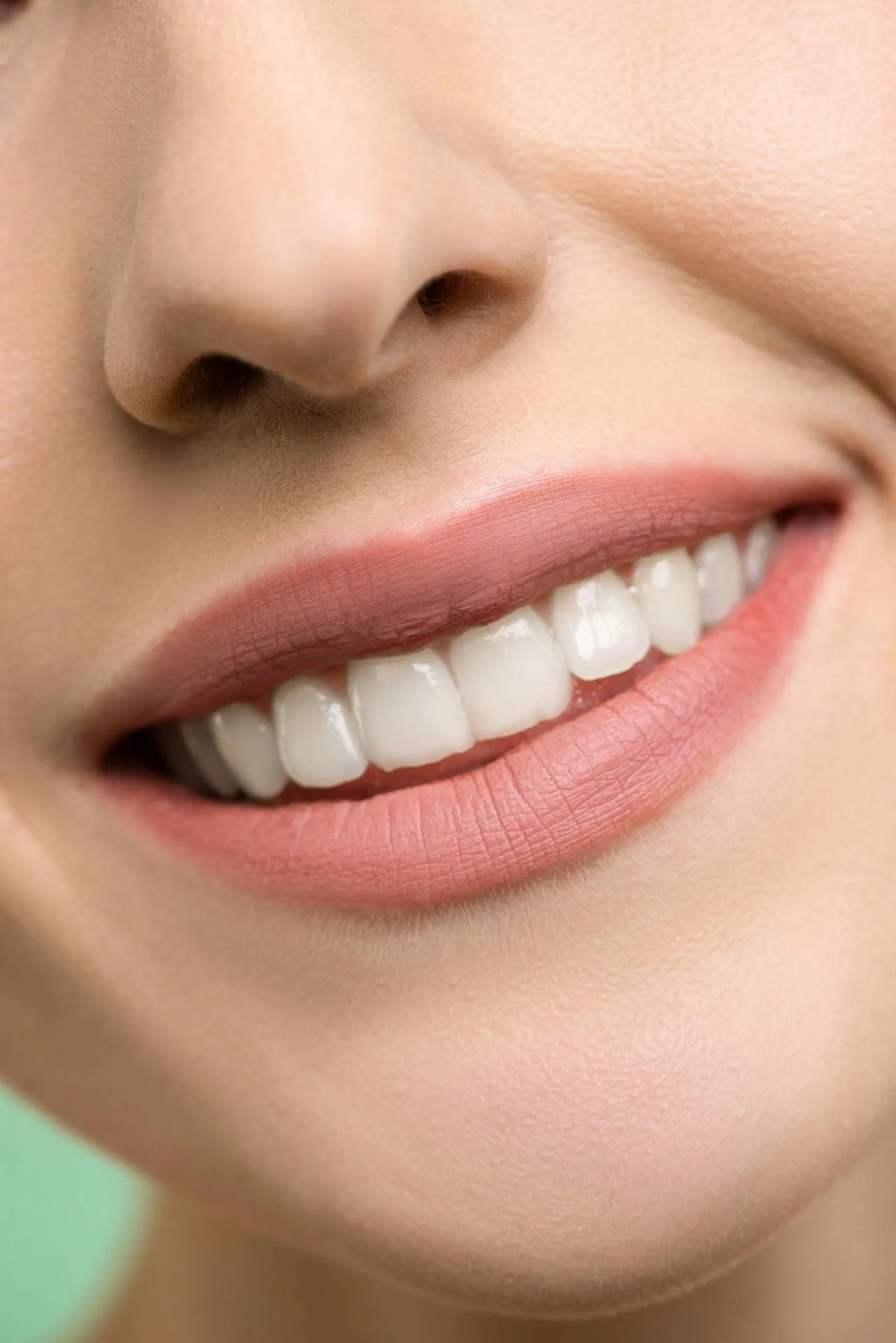 Stunning Hollywood Smile result — perfectly aligned, bright white teeth after cosmetic dental treatment in Turkey, the kind of result achieved at Taki Dent
